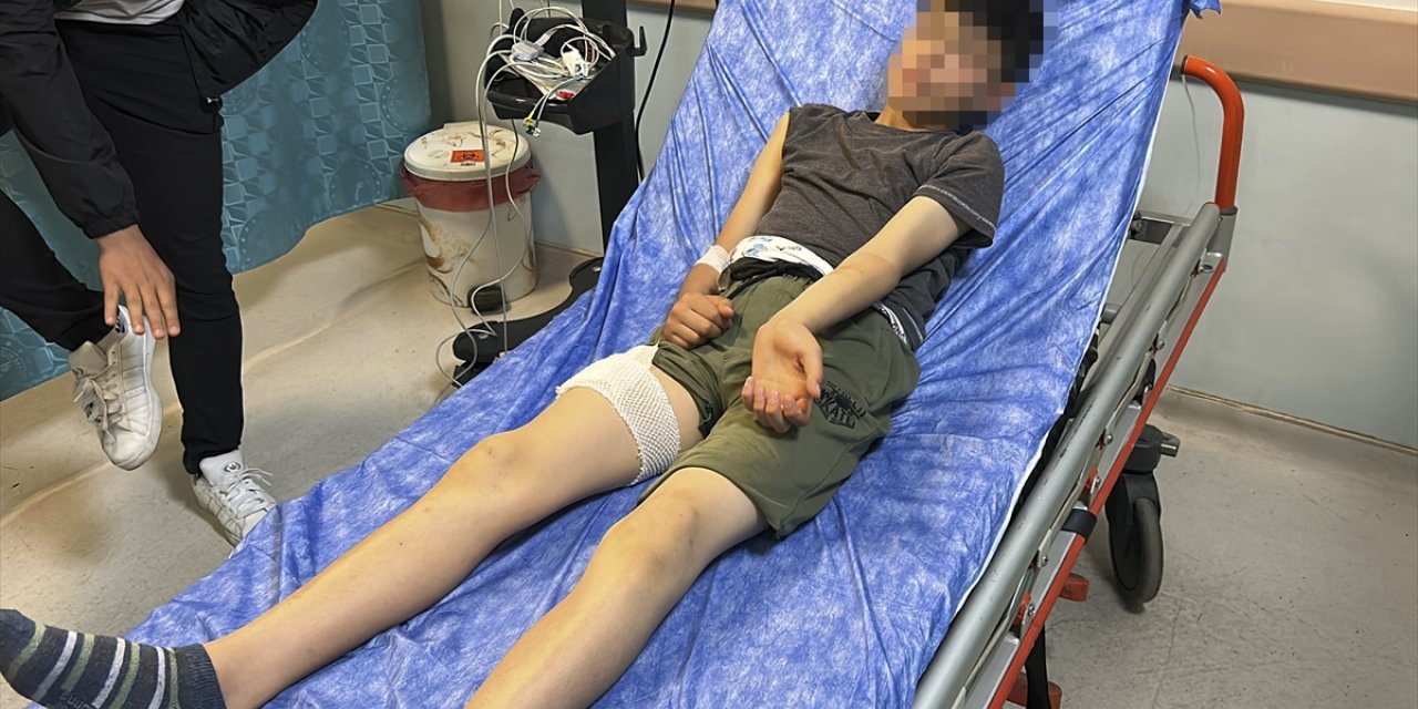Sivas'ta sahipsiz köpeğin saldırdığı çocuk yaralandı