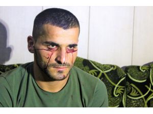 "Kan ağlayan" Iraklı genç hastalığına çare arıyor