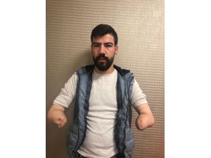 GÜNCELLEME 2 - Akdeniz Üniversitesi Hastanesinde çift kol nakli yapıldı