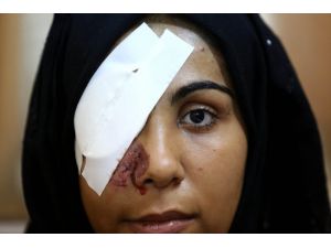 Filistinli genç kız, Gazze'deki Büyük Dönüş Yürüyüşü gösterilerinde gözünü kaybetti
