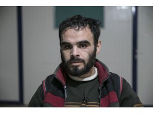 Suriyeli Maguni protez eline kavuşacağı günü bekliyor