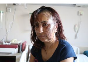 Boşanma davası açtığı kocasının kezzaplı saldırısına uğrayan kadın yaralandı