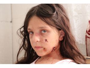 Samsun'da pitbull saldırısına uğrayan çocuk yaralandı