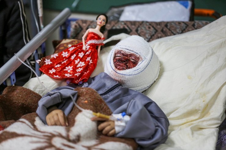 Filistinli 4 yaşındaki kız çocuğu Seca, İsrail saldırısının acısını yüzünde taşıyor