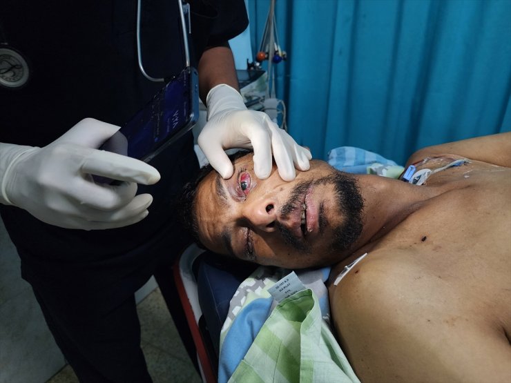 İsrail'in alıkoyduğu Filistinli, organlarının bir kısımını ve görme yetisini kaybetti