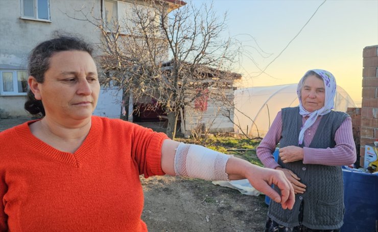 Çorum'da köpeğin saldırısına uğrayan 3 kişi yaralandı